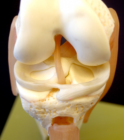 meniscus tear