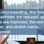 microneedling, dermapen, Dr. Dhai Barr's treatment room overlooking the Willamette River