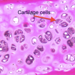 Cartilage regeneration