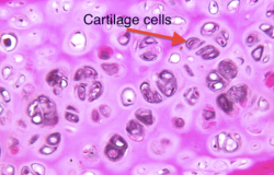 Cartilage regeneration