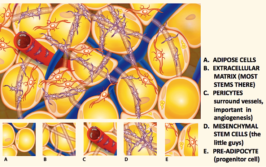 Same-Day Adult Stem Cell Procedure in Portland, Oregon