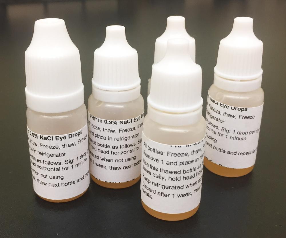 Oregon Regenerative Medicine PRP eye drops for dry eyes