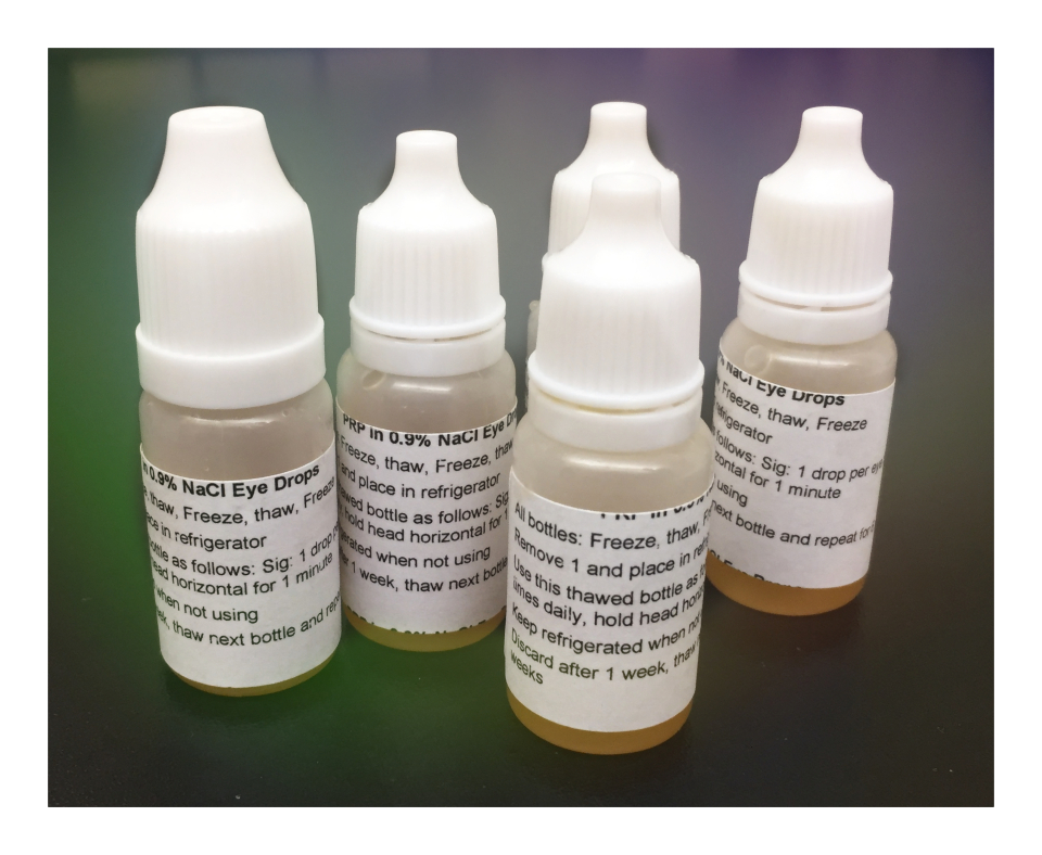 PRP Eye Drops: They gave me back my life - Oregon Regenerative Medicine