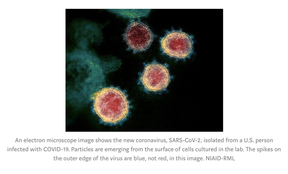 SARS-CoV-2 isolated from a US person infected with OCVID-19.