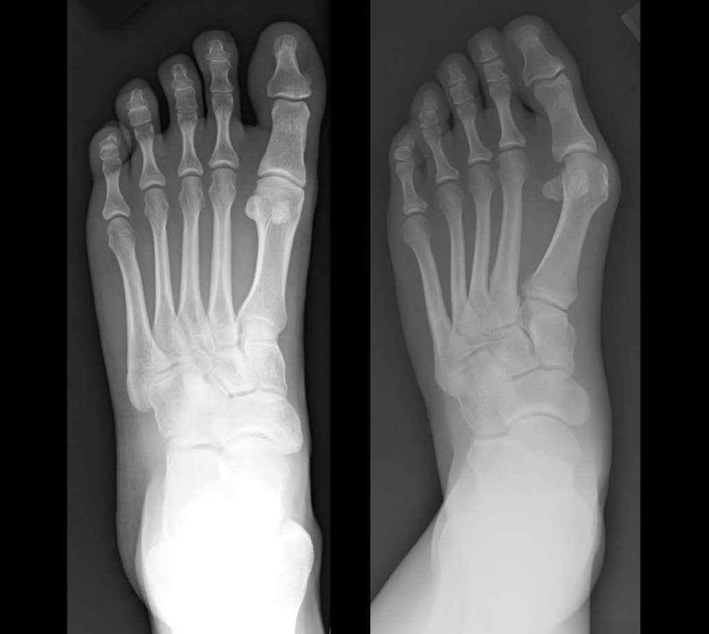 X-Ray Socks: Realistic foot and leg bone socks are creepy