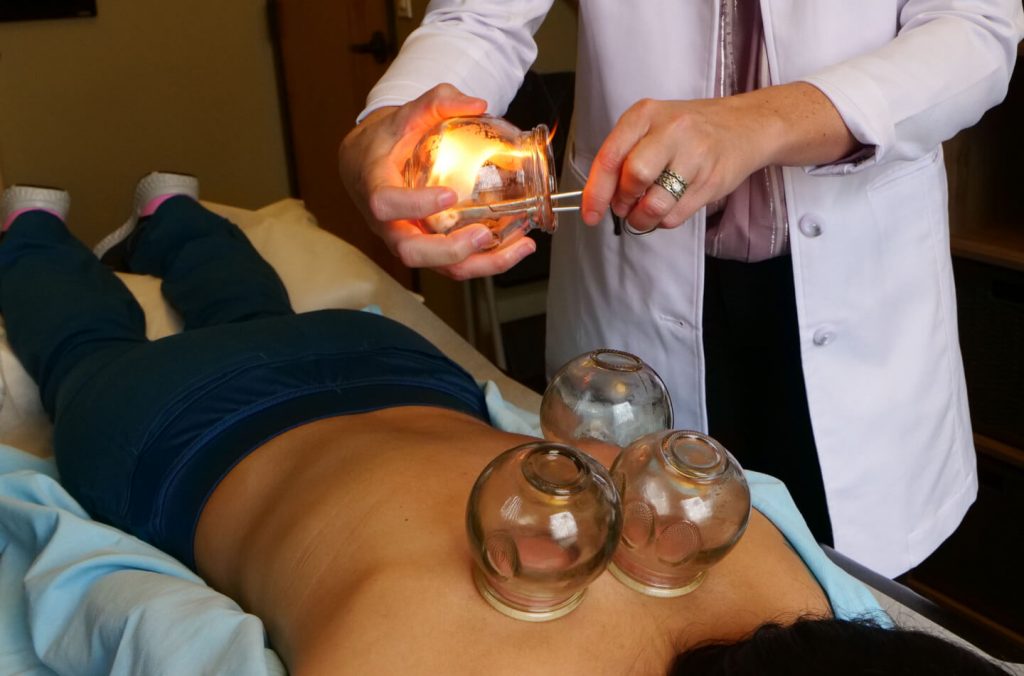 How Cupping Can Help Chronic Muscle Tension & Pain - Lakes