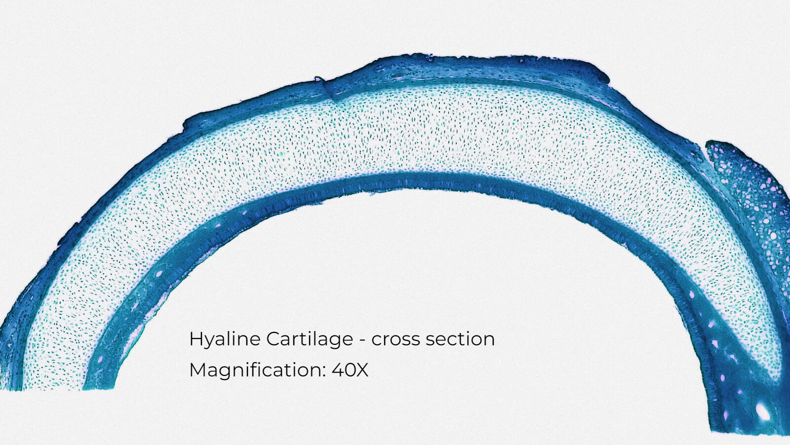 joint articular cartilage