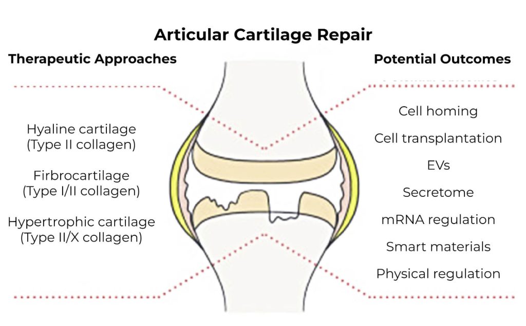 joint articular cartilage repair