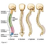 posterior pelvic tilt