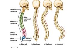 posterior pelvic tilt